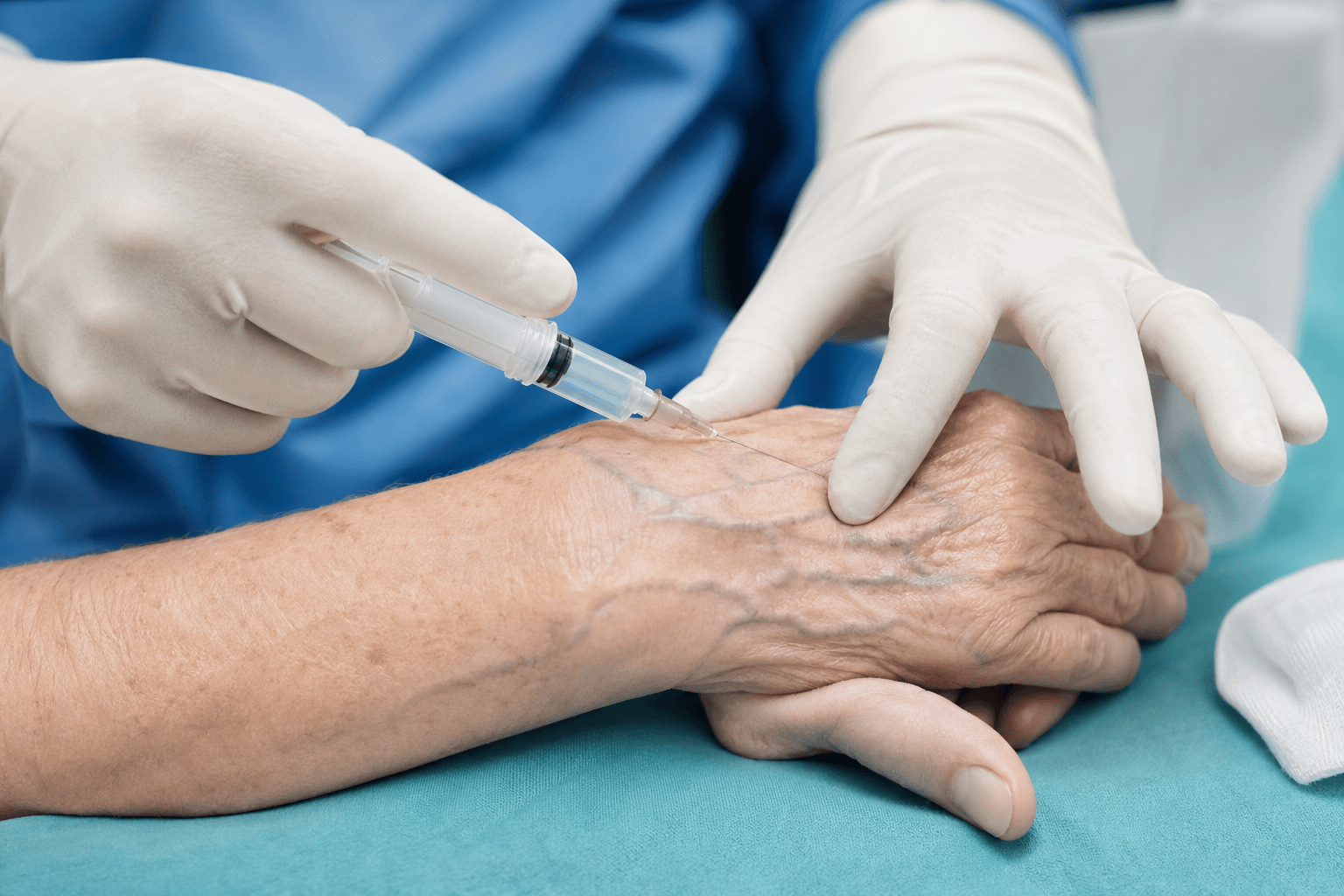 Physician treating prominent hand veins with injection therapy