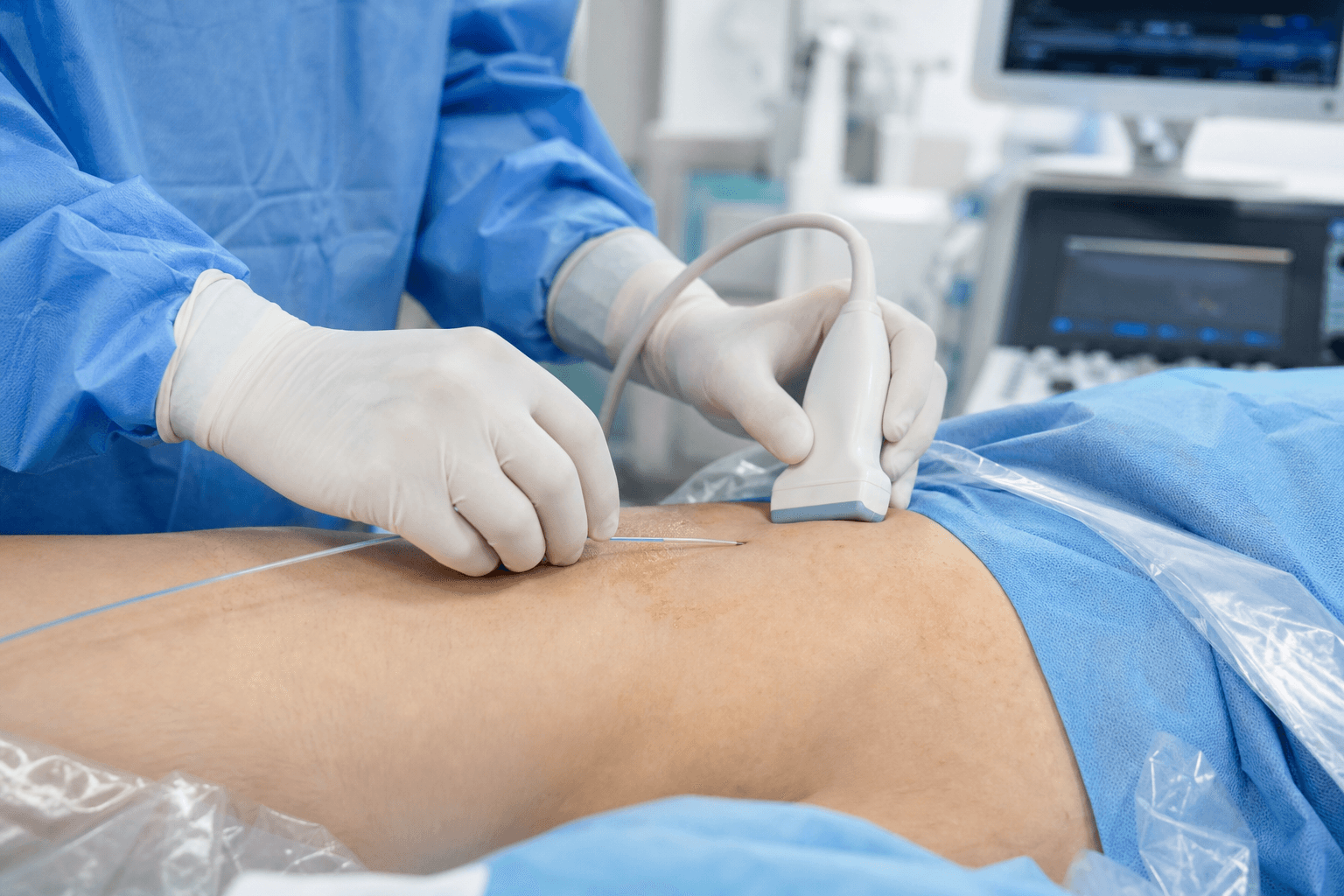 Physician performing ultrasound-guided radiofrequency ablation procedure on patient's leg at New York vein clinic
