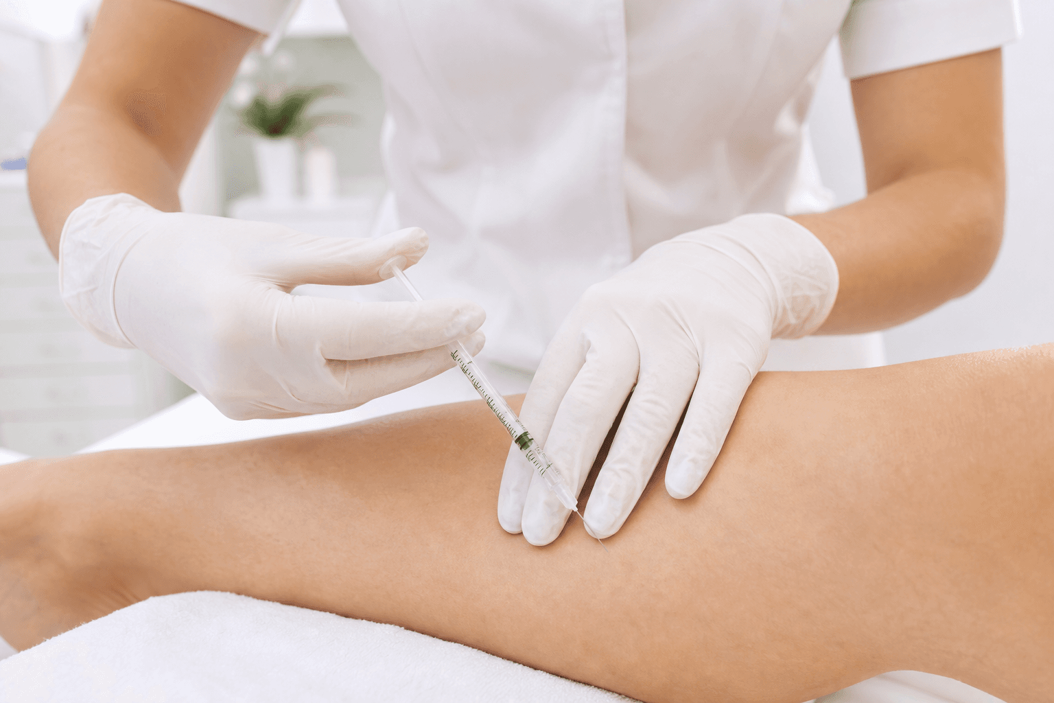 Physician administering sclerotherapy injection for spider vein treatment in a New York vein clinic