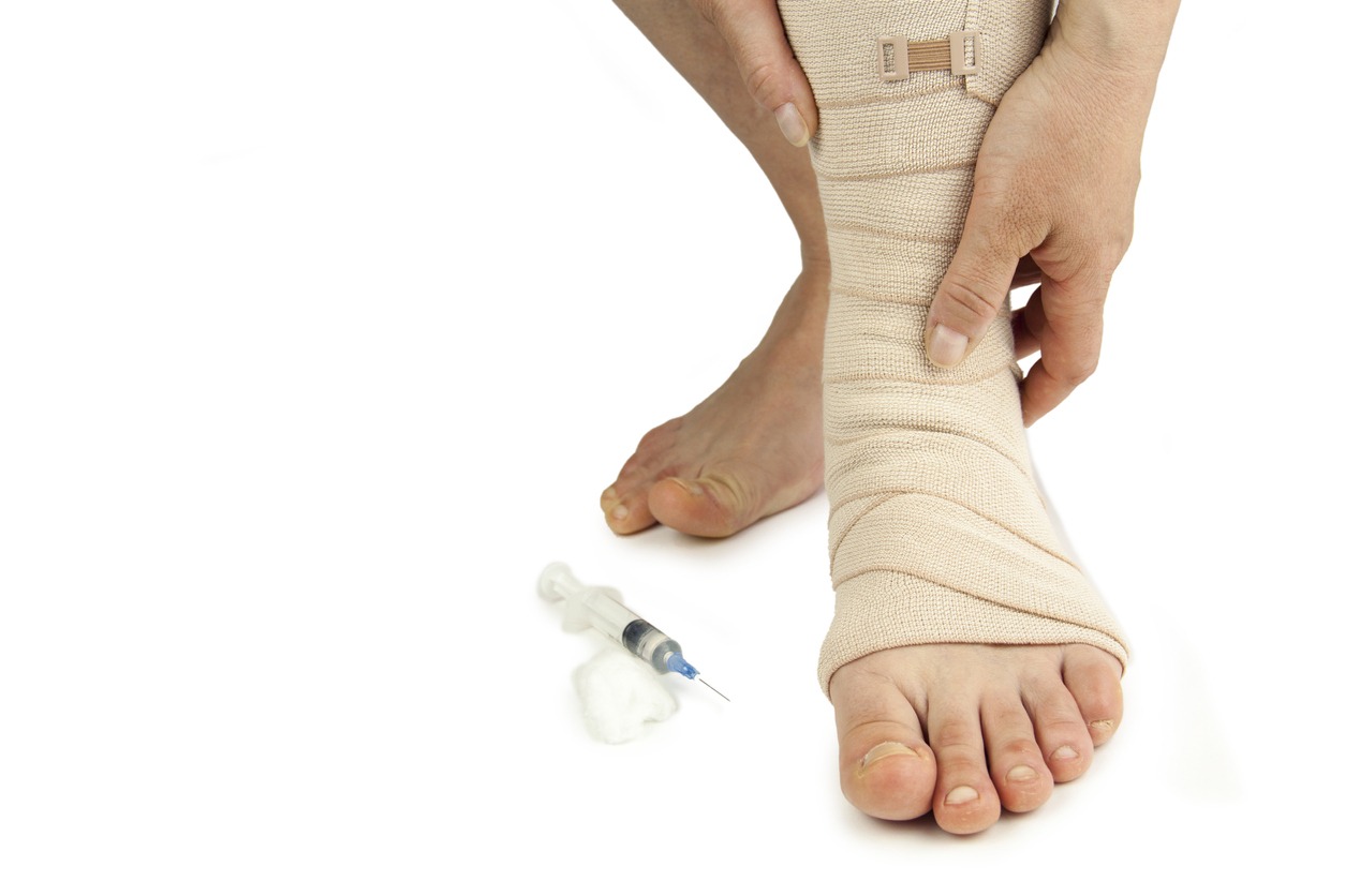 Get Compression Stockings Fitted Quickly Long Island, NY
