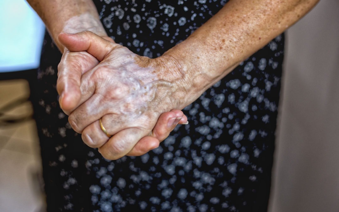 hand veins